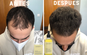 Serum Capilar pro®️