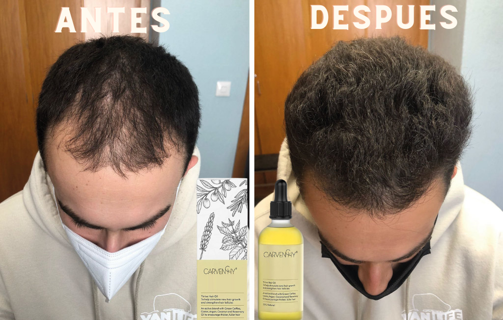 Serum Capilar pro®️